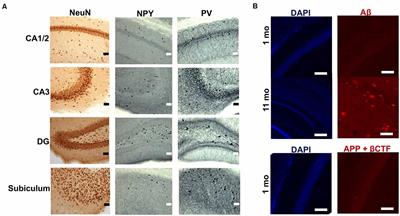 Phenotypic Alterations in Hippocampal NPY- and PV-Expressing Interneurons in a Presymptomatic Transgenic Mouse Model of Alzheimer’s Disease